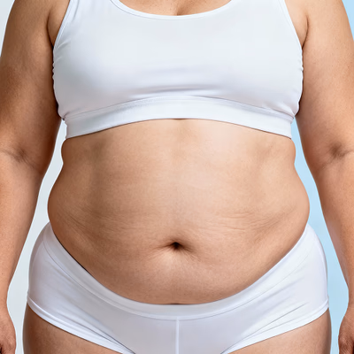 Belly fat