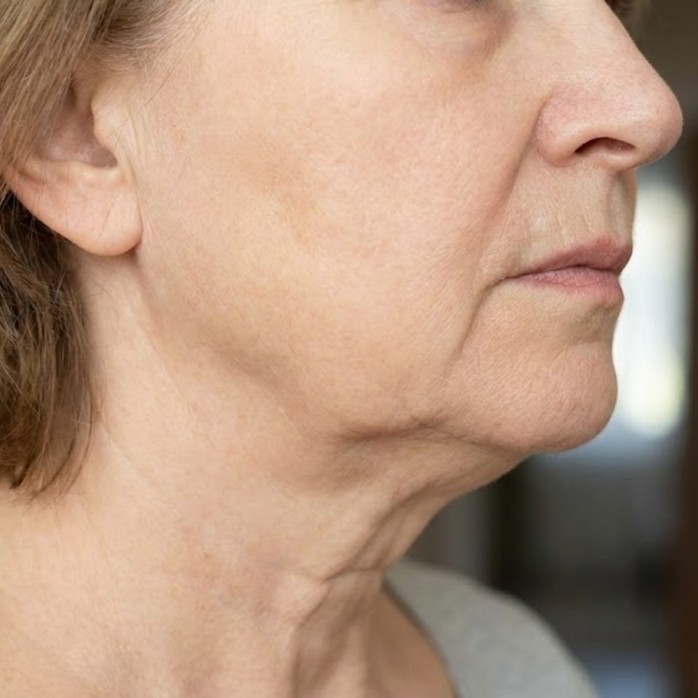 My jawline is disappearing into jowls