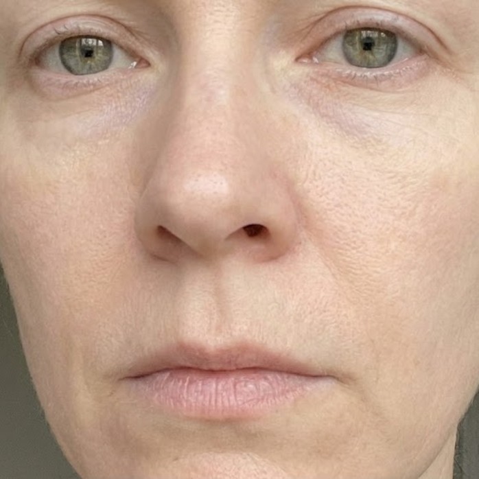 My skin is thin, dull, and lifeless