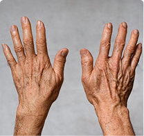 Hands