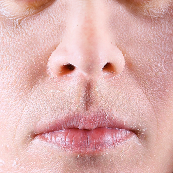 Dry or tight skin