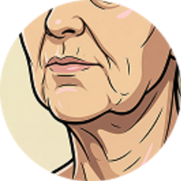 Sagging Jowls