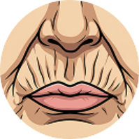 Smokers/Lip Lines