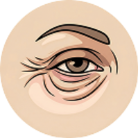 Eye Wrinkles