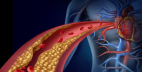 Lower cholesterol