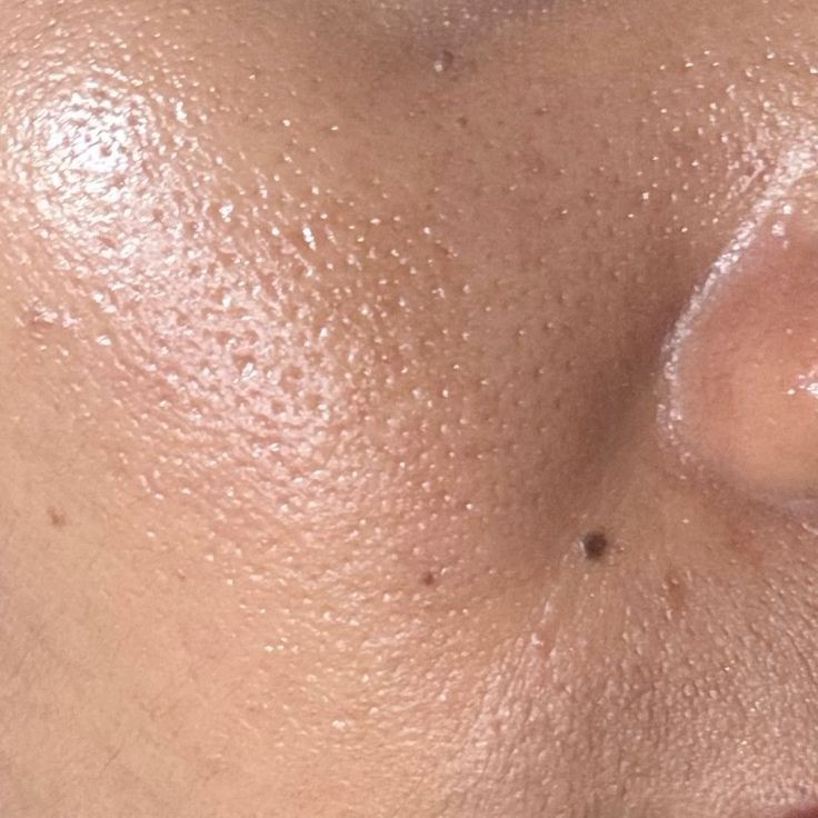 Oily
