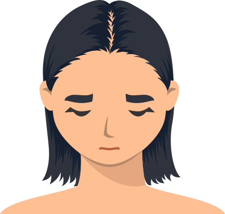 Noch nicht – aber ich möchte Haarausfall vorbeugen