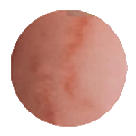 Striae Rubrae & Albae