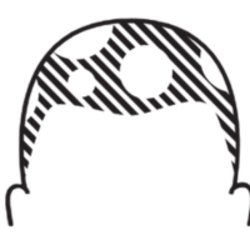 Patchy (coin-sized bald spots)