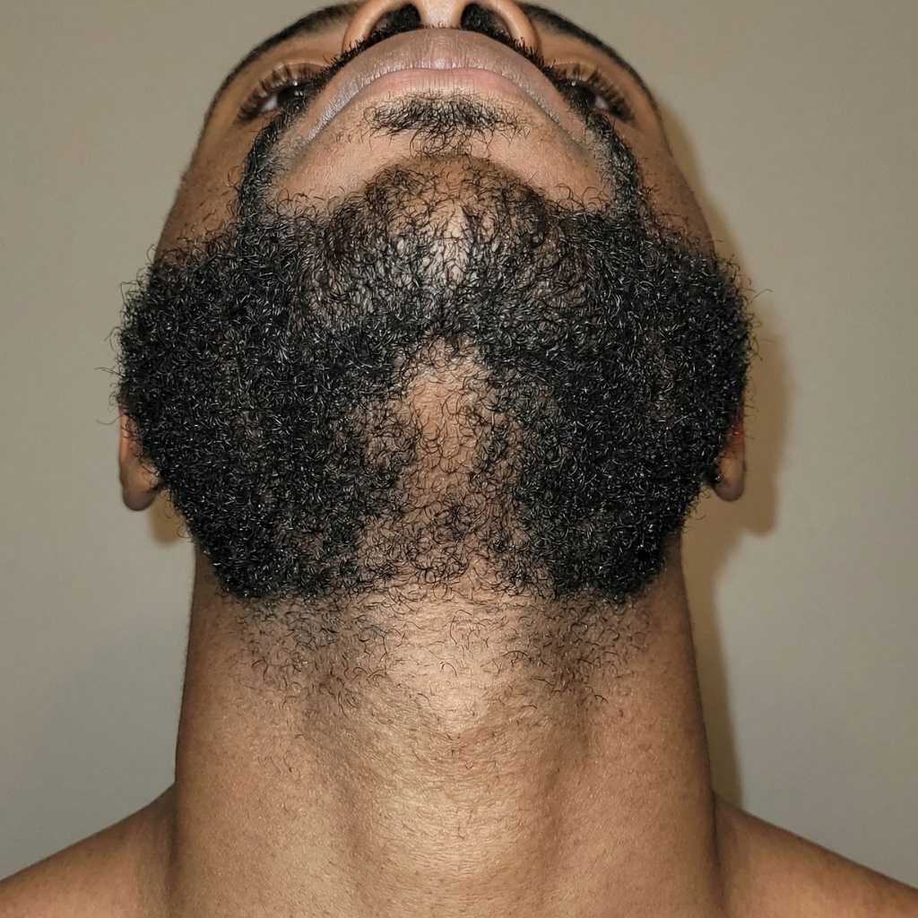 Neck / Under chin