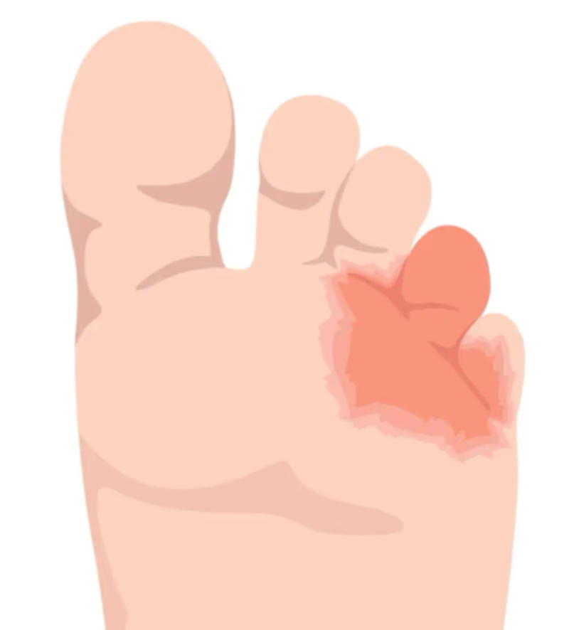 Mild- Some redness or itching