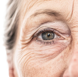 Ojos