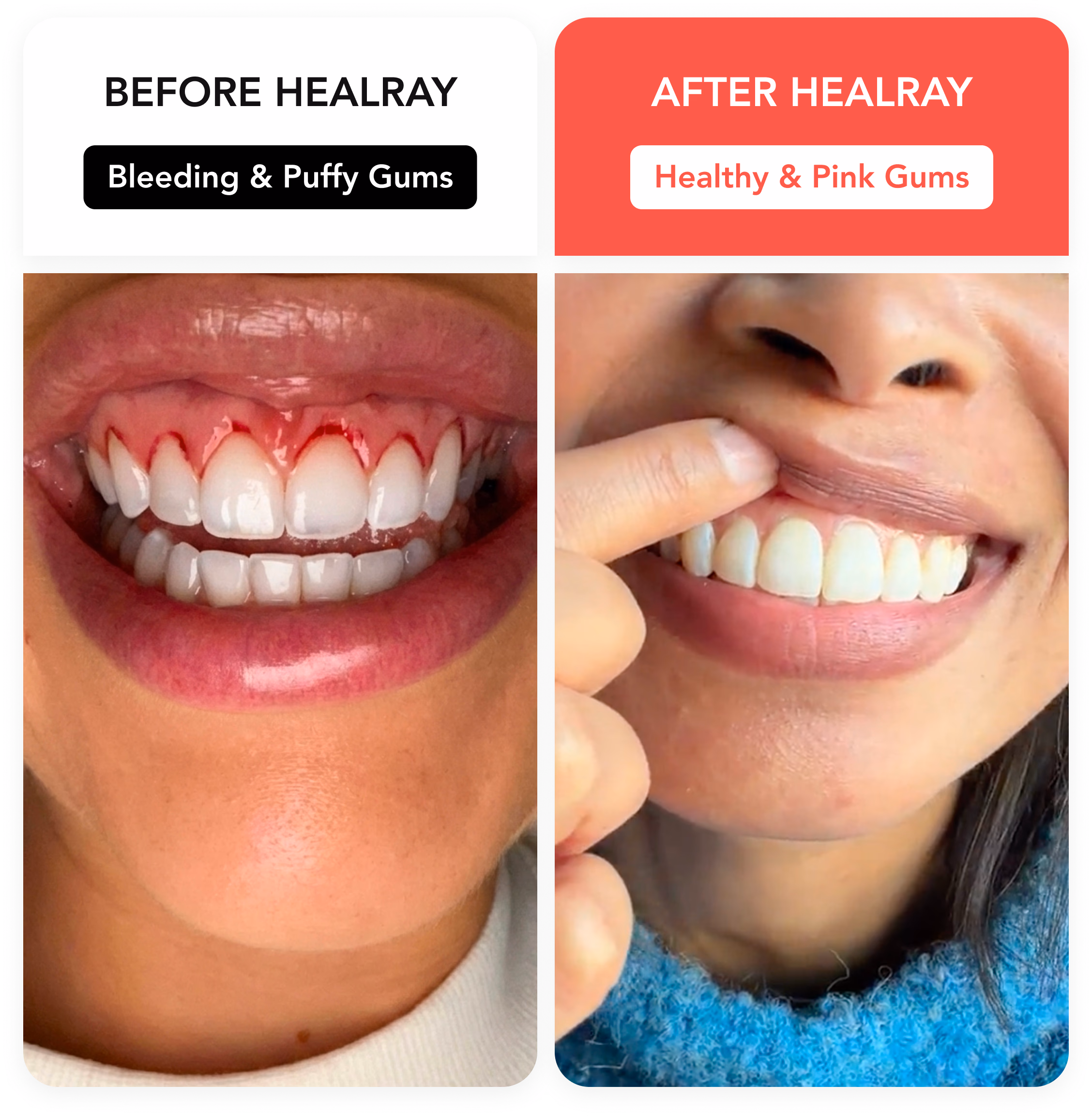 HealRay before and after result 3