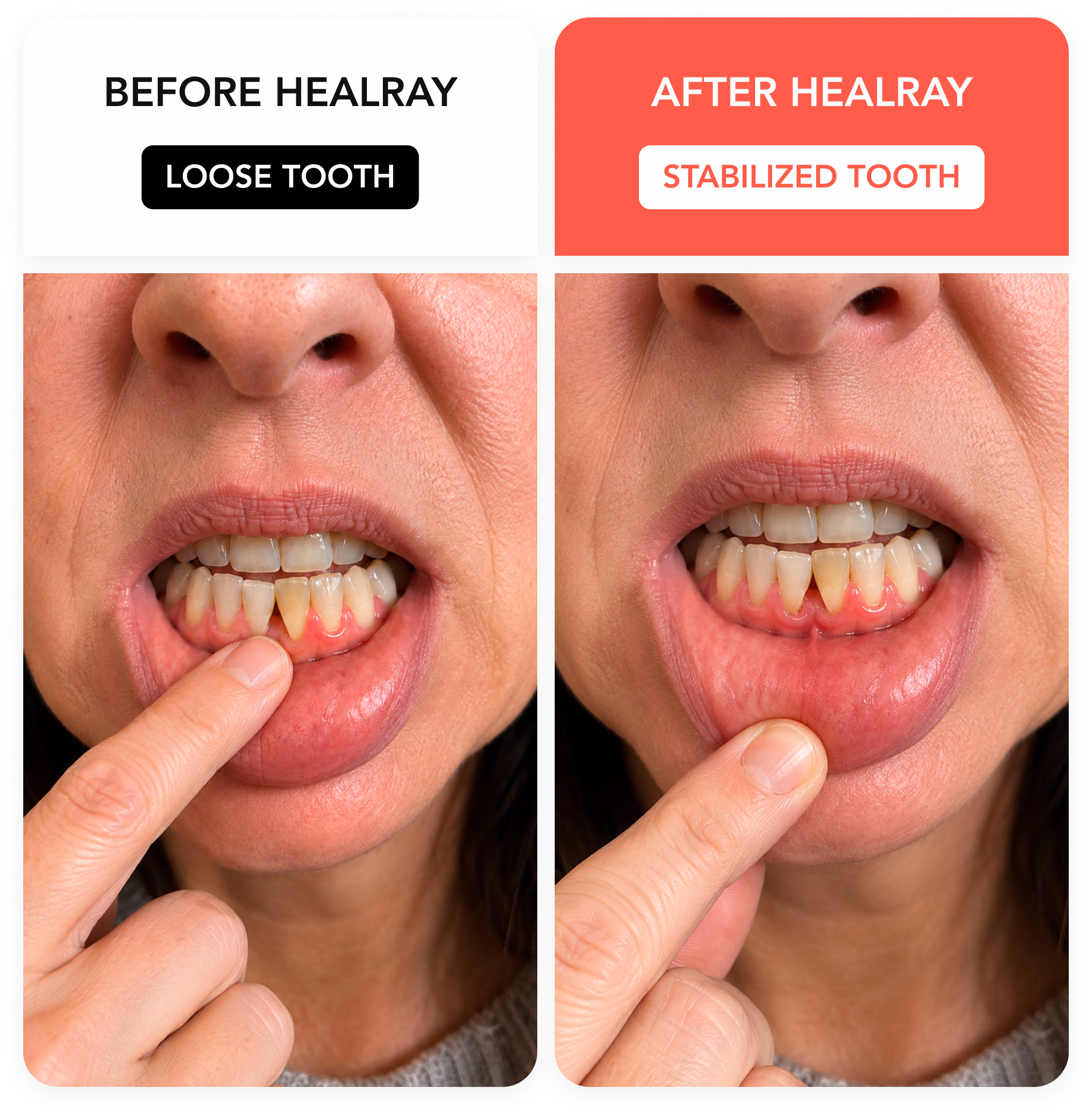 HealRay before and after result 2