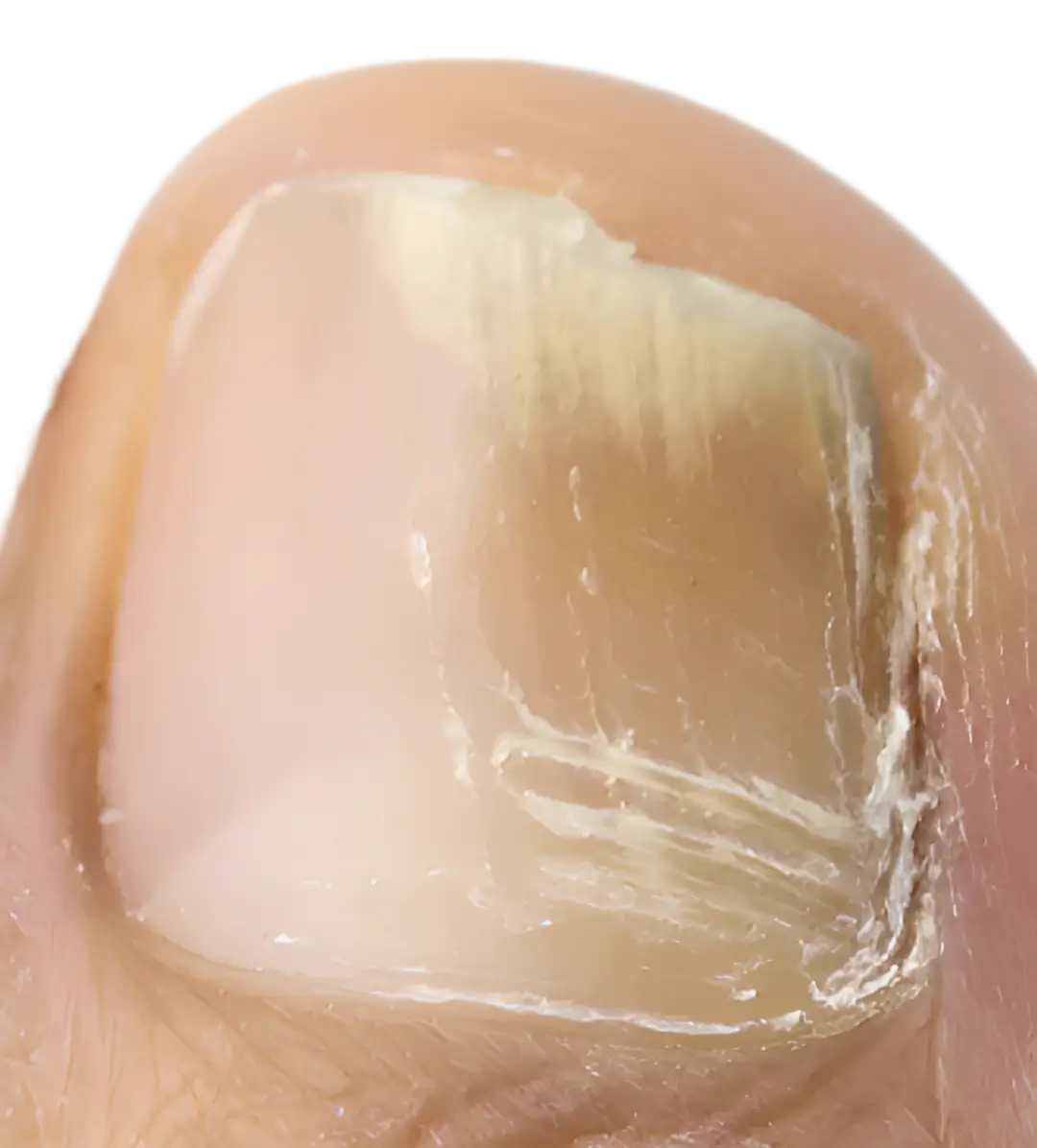 Discoloration (yellow, brown, or white spots)