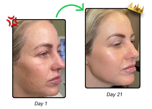 Customer skin on day 1 and day 21