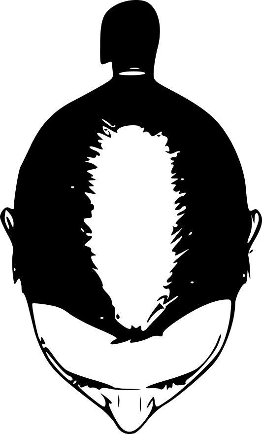 Gesamter Kopf (diffuser Haarausfall)