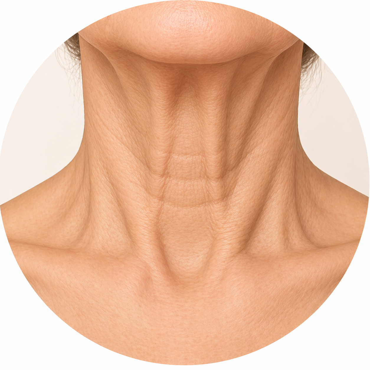 Turkey Neck