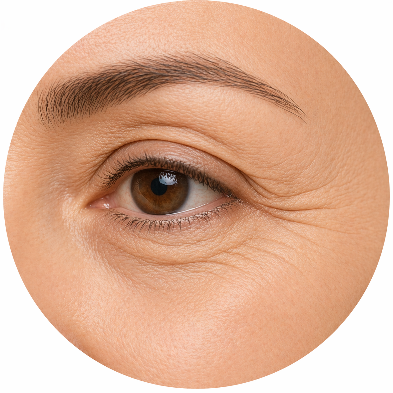 Eye Wrinkles