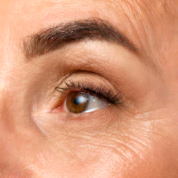 Eye Wrinkles