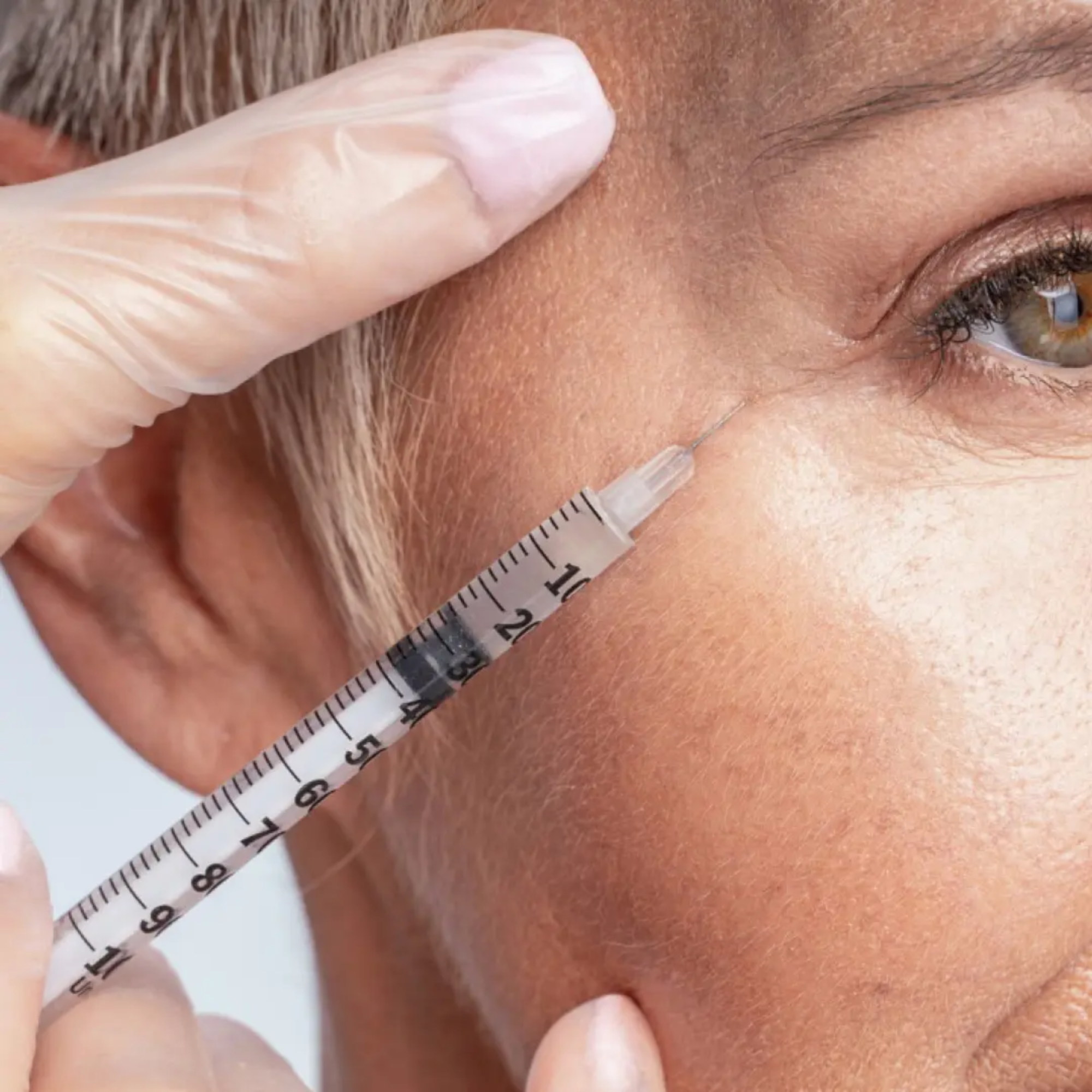 Botox, fillers, or injections