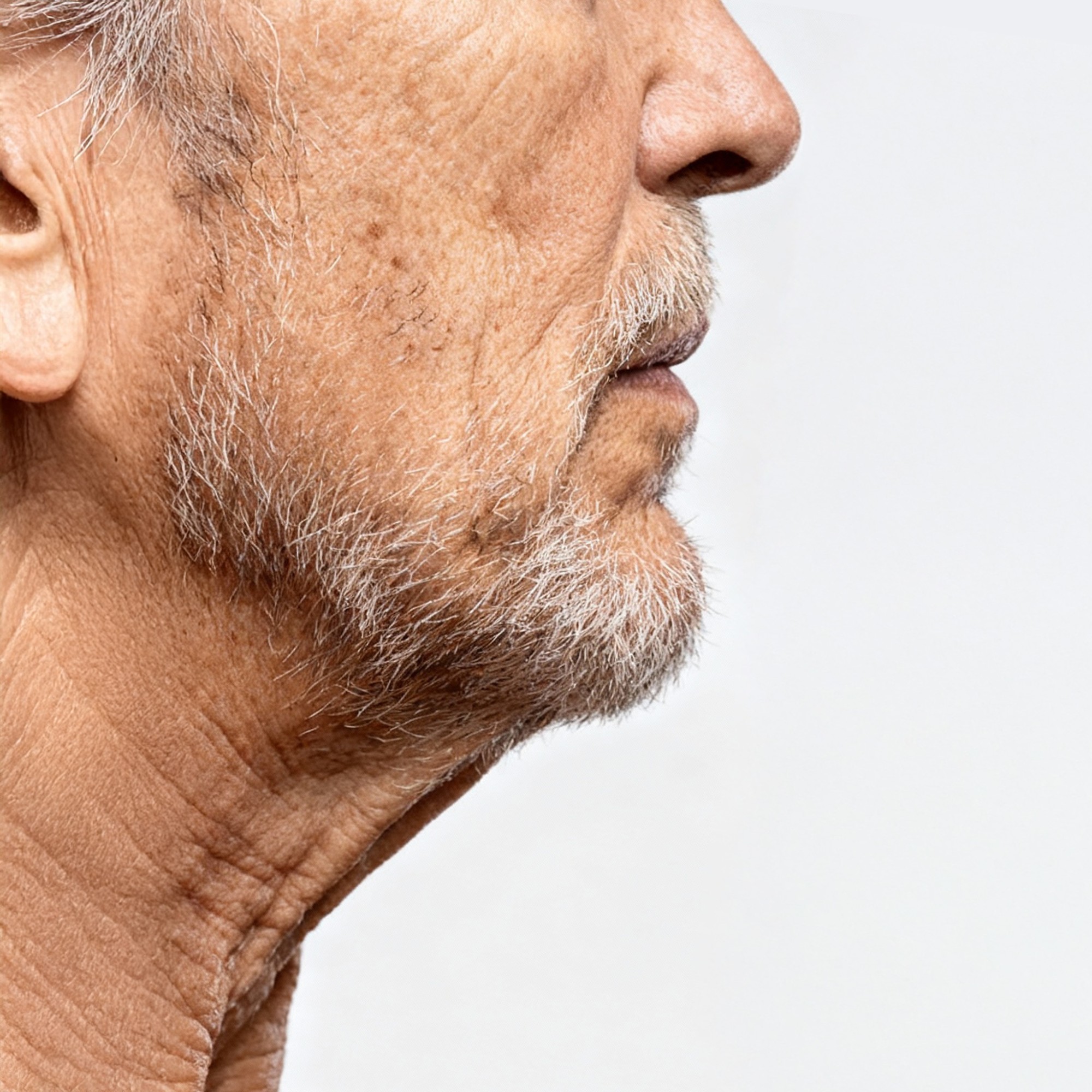 Turkey neck / loose neck skin
