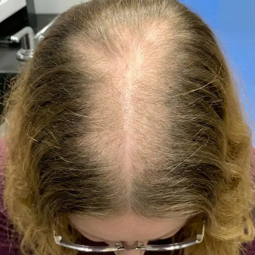 Part Line