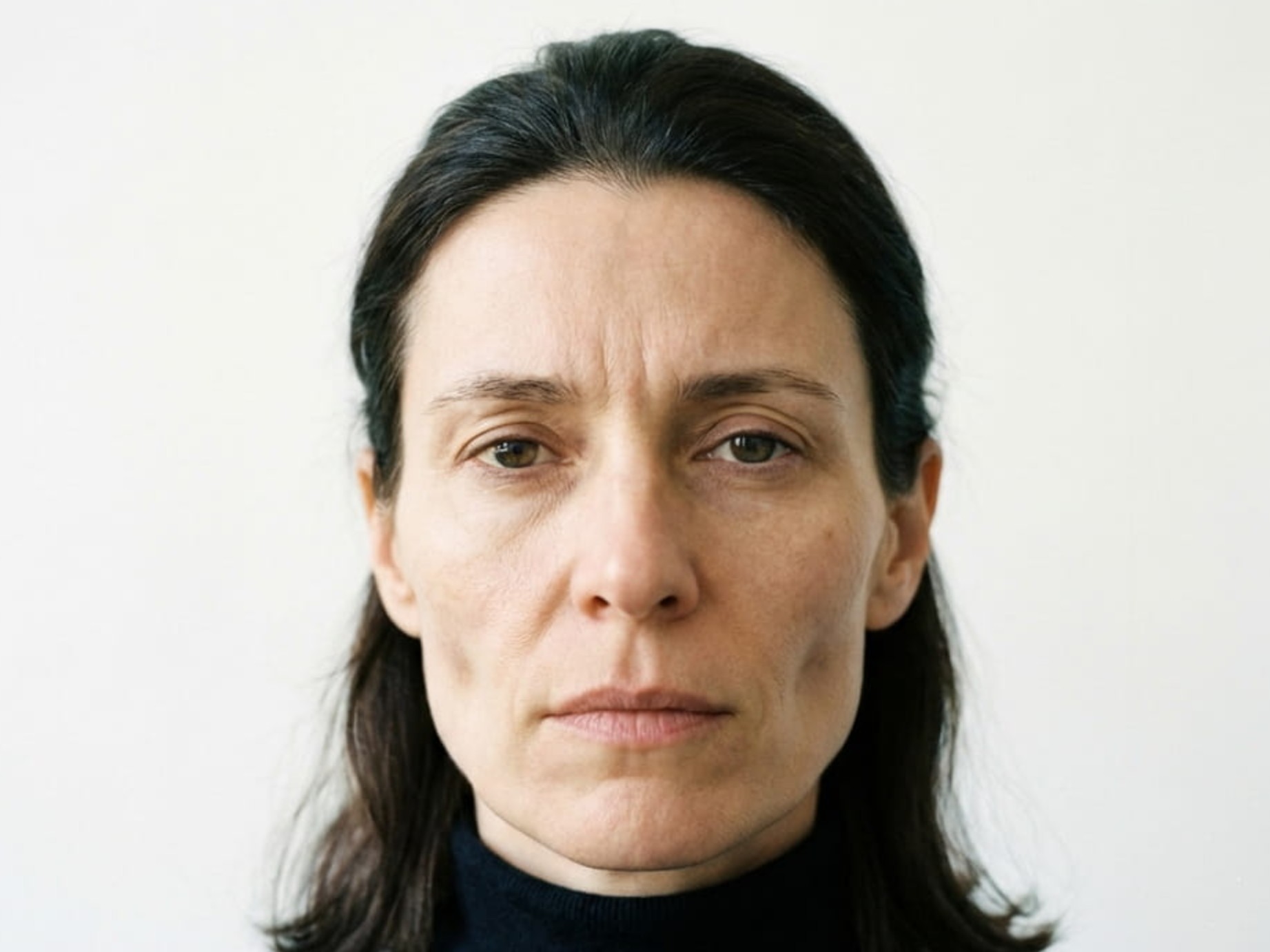 Das Gesicht ist schmaler geworden (Diätgesicht)
