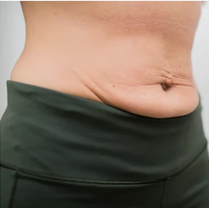 Lower Belly Pouch
