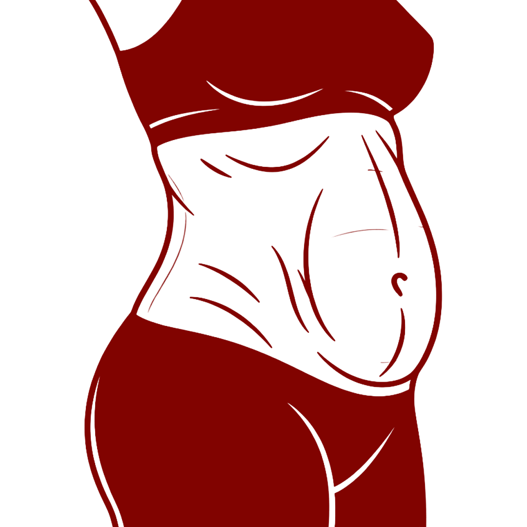 Option C