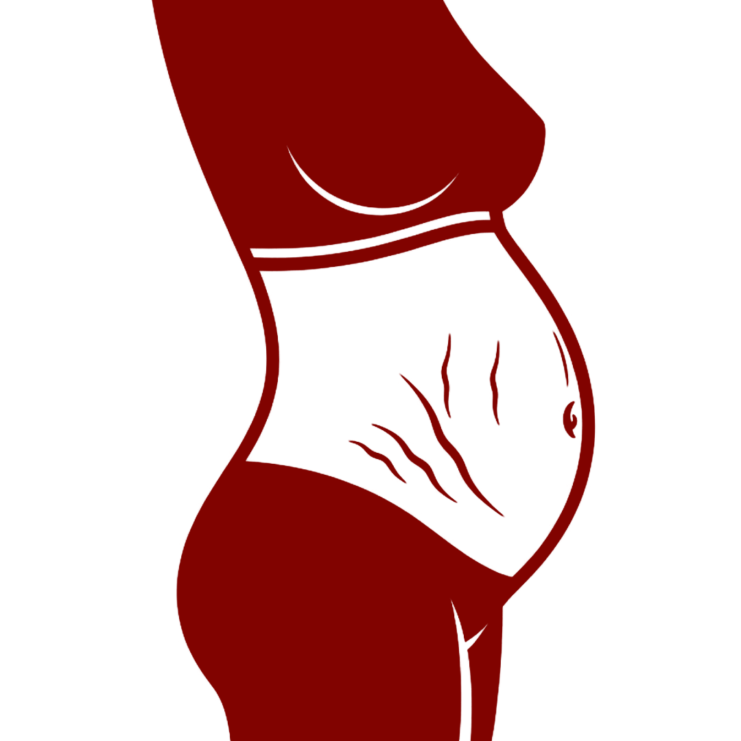 Option A