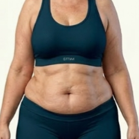 Significantly overweight