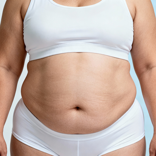 Belly fat