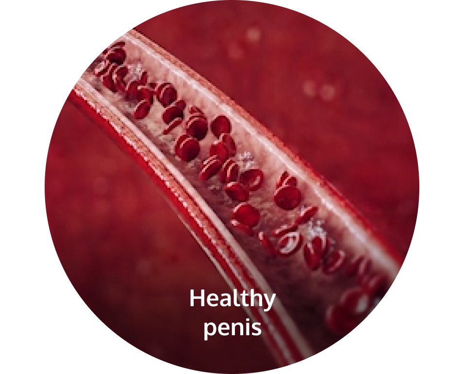 Healthy penis, internal view