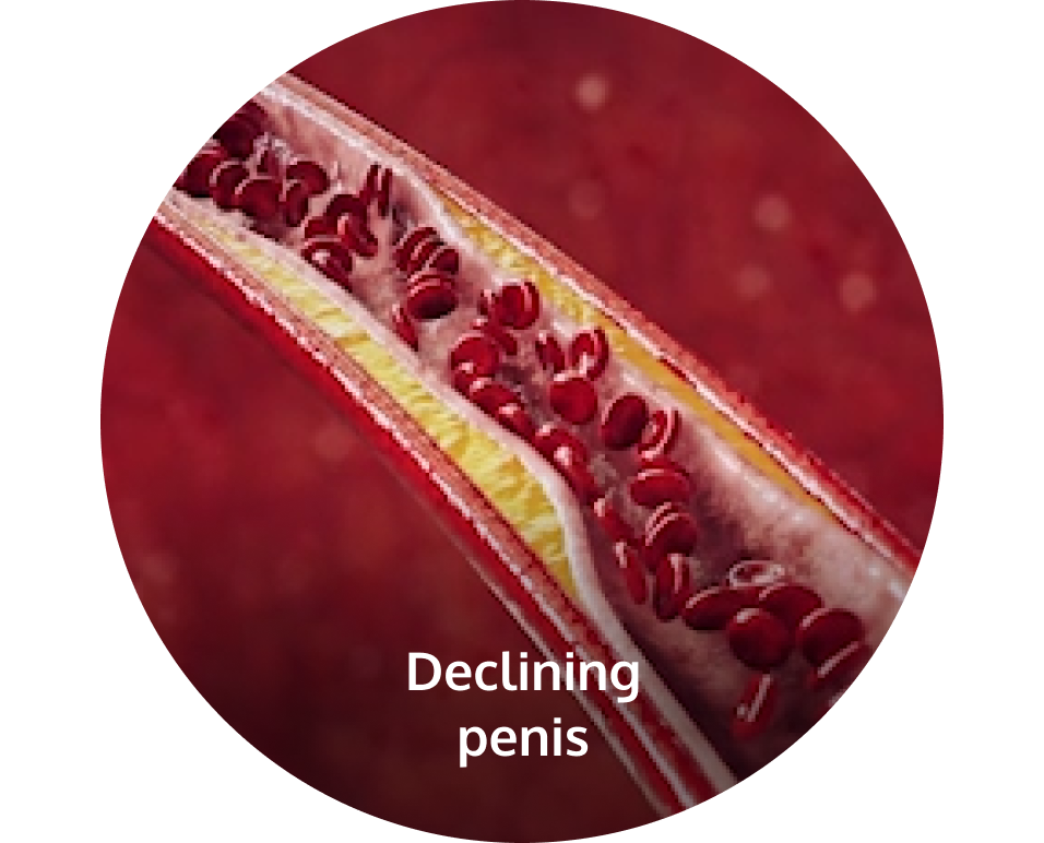 Declining penis, internal view