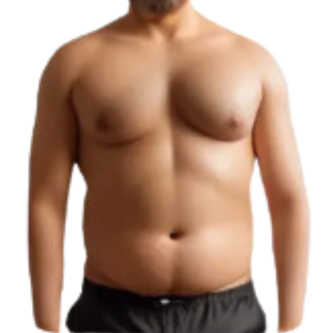 Endomorph