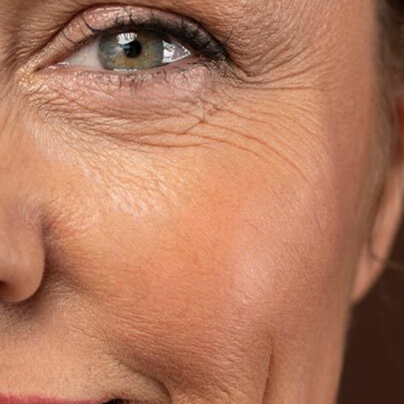 Fine lines & wrinkles