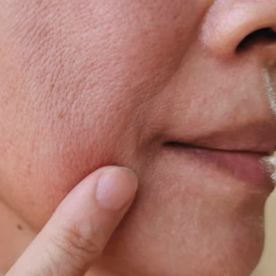 <strong>Dull, tired-looking skin</strong>