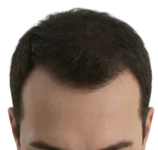 Hair Analysis