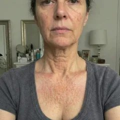 Now